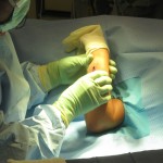 both bone forearm04 open pediatric forearm fracture