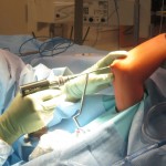 both-bone-forearm07 ulna fracture