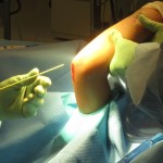 both-bone-forearm08 ulnar fracture