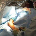 both-bone-forearm09 radius fracture fixation