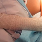 both-bone-forearm11 greenstick fracture